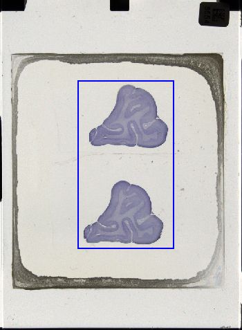 Media type: image; Special Collections 3043   shows specimen_part histological serial section;